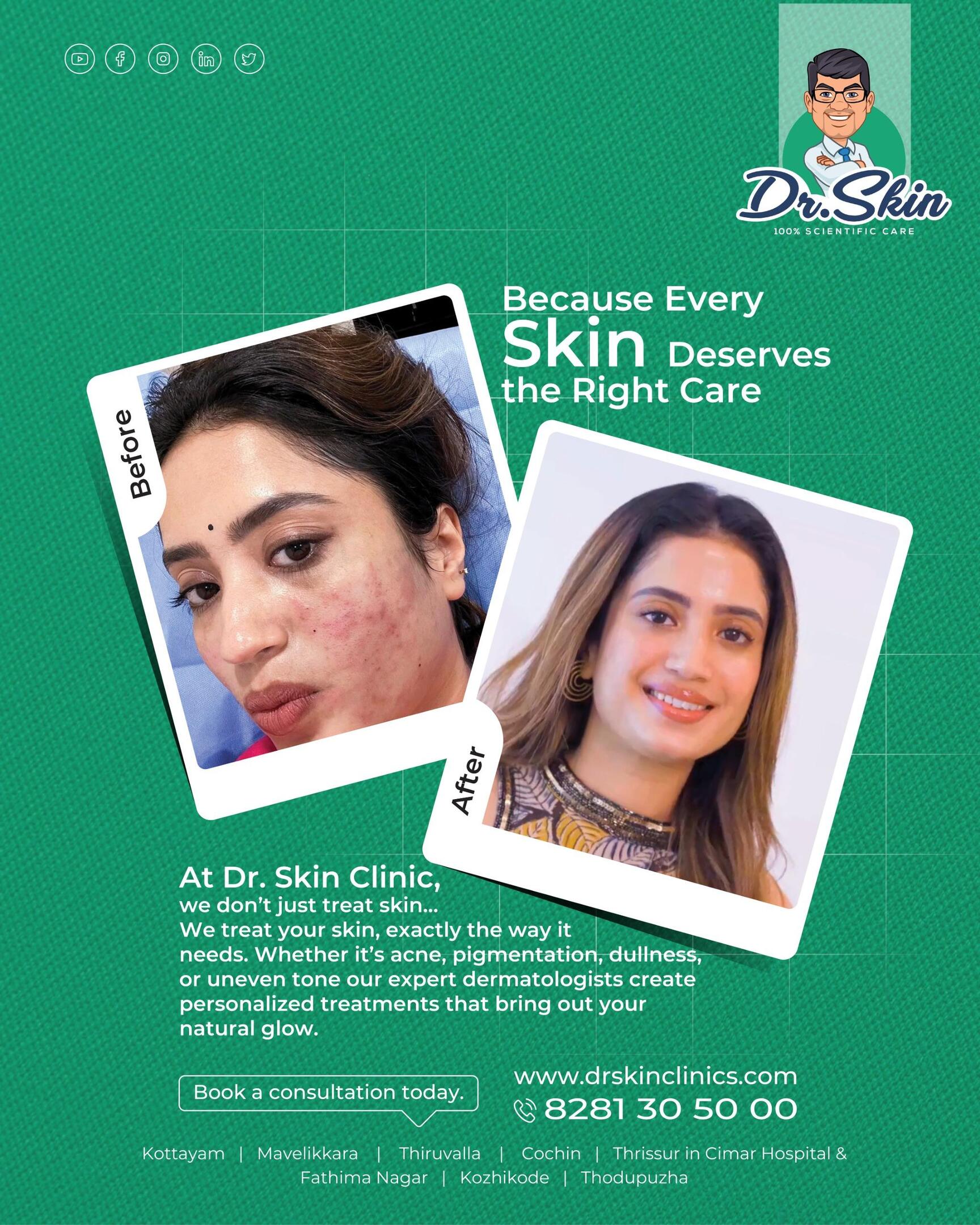 glutathione treatment in kottayam Dr. Skin Clinic Athirampuzha,Kottayam - Best Clinics in Glutathione Cell-Based Detection Kit