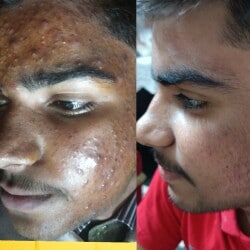 Skin and Hair Clinic in Sikandra,Agra - Best Skin Care Clinics in Agra - Justdial Skin and Hair Clinic in Sikandra,Agra - Best Skin Care Clinics in Agra - Justdial