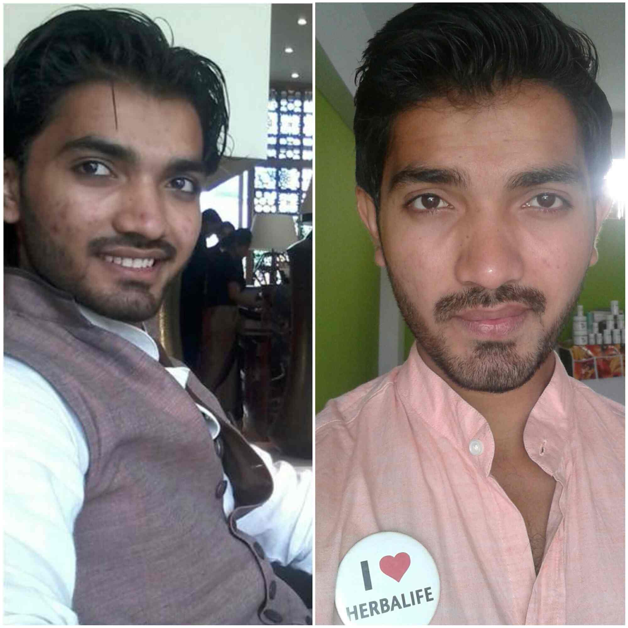 Roohi Nutrition in Juhapura,Ahmedabad Best Weight Loss Centres in