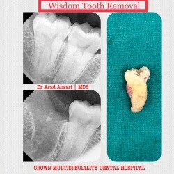 Top Dental Hospitals in Bapunagar, Ahmedabad - Best Dentistry ...