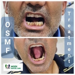 premium dental implants in Dwarka – Lessons Learned From Google
