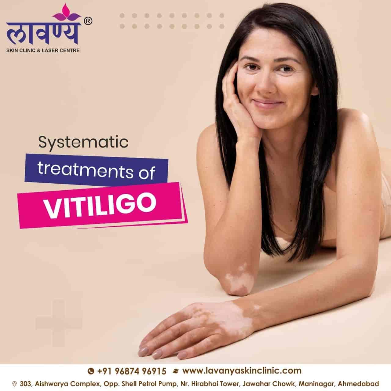 Lavanya Skin Clinic in Maninagar,Ahmedabad Best Cosmetic Laser