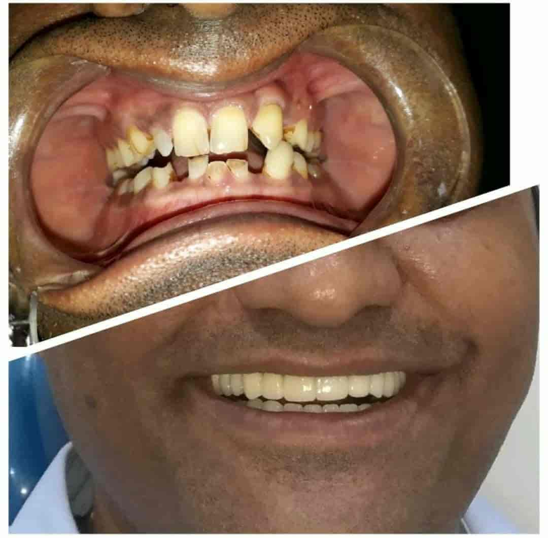 Orthosquare Dental Clinic in Prahladnagar,Ahmedabad Best Dental