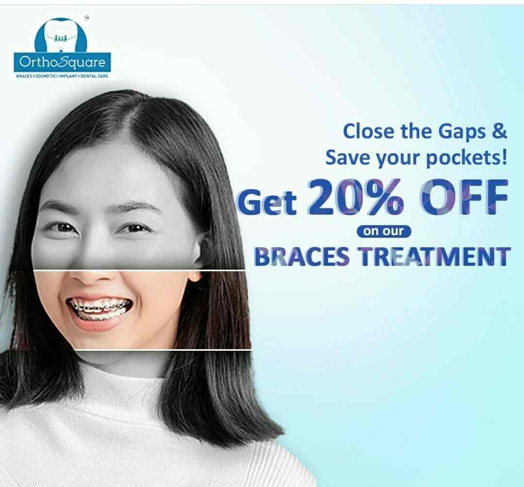 Orthosquare Dental Clinic in Prahladnagar,Ahmedabad Best Dental