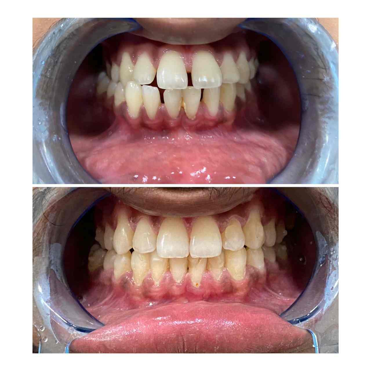 Orthosquare Dental Clinic in Prahladnagar,Ahmedabad Best Dental