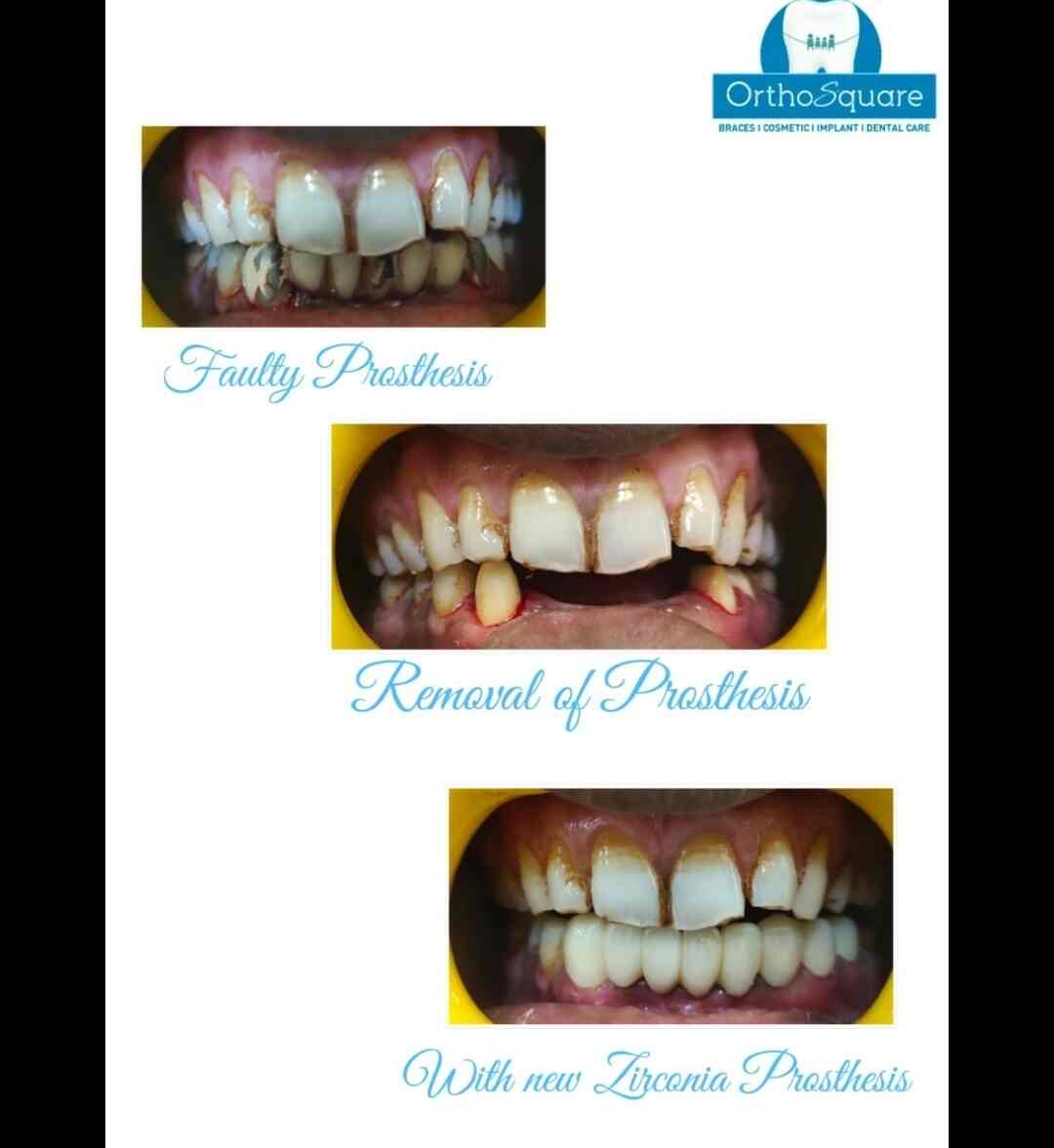 Orthosquare Dental Clinic in Prahladnagar,Ahmedabad Best Dental