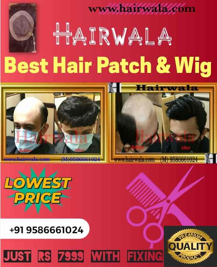 Update 62+ hair patch in ahmedabad in.eteachers
