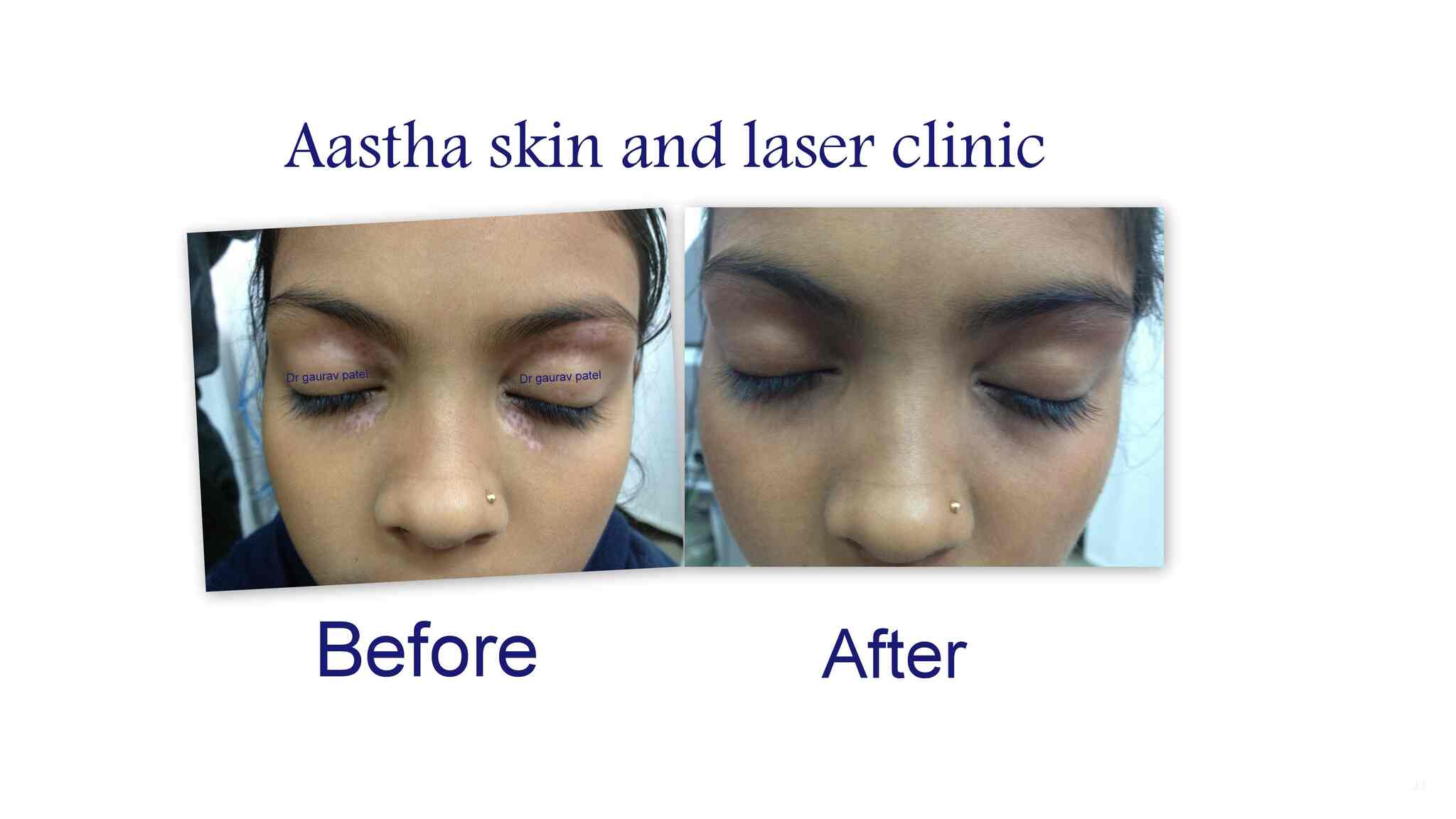 aastha skin clinic