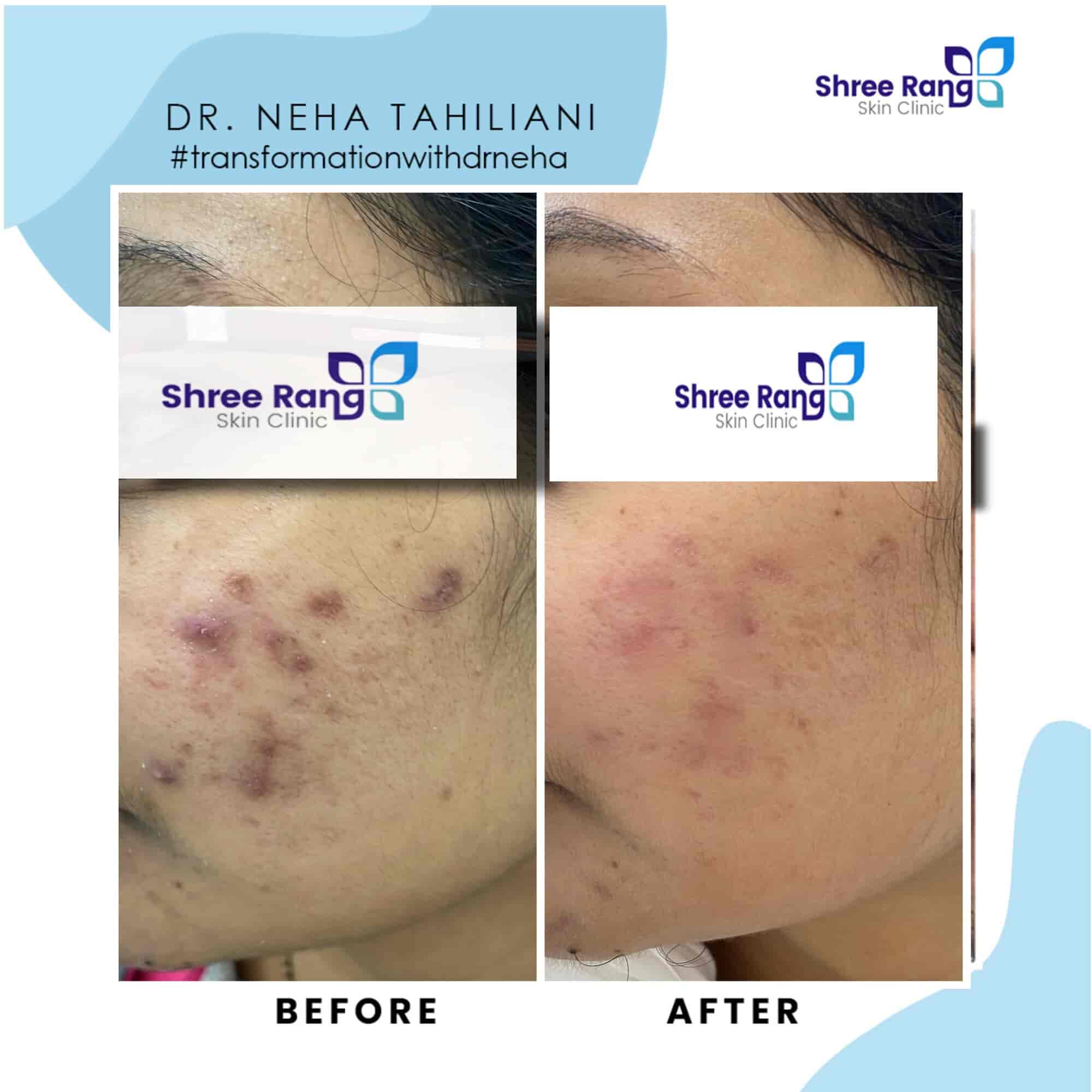 Top Dermatologists in Gota, Ahmedabad Best Skin Specialist near me