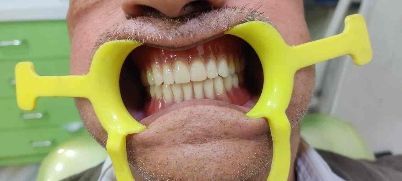 Top Dental Laboratory in Kalana Best Dental Labs Ahmedabad near me