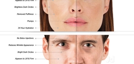 Top Women Beauty Clinics For Permanent Hair Removal In Nikol Best