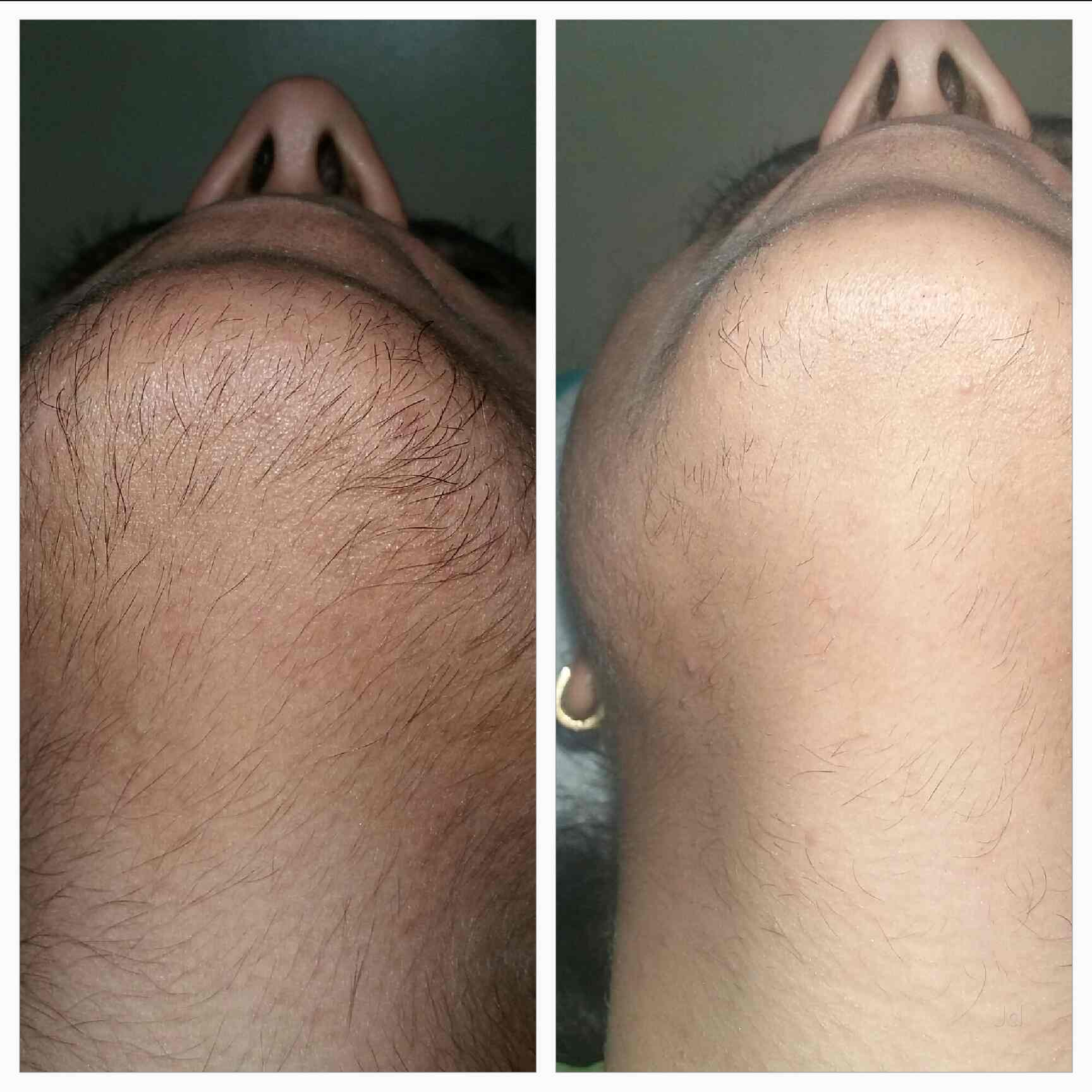 Top Skin Polishing Doctors in Kashti, Ahmednagar Best Skin