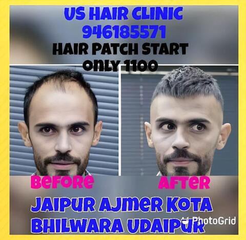 Hair Specialist Doctor in Vaishali Nagar, Ajmer - Dr Batra's® Homeopathy  Clinic