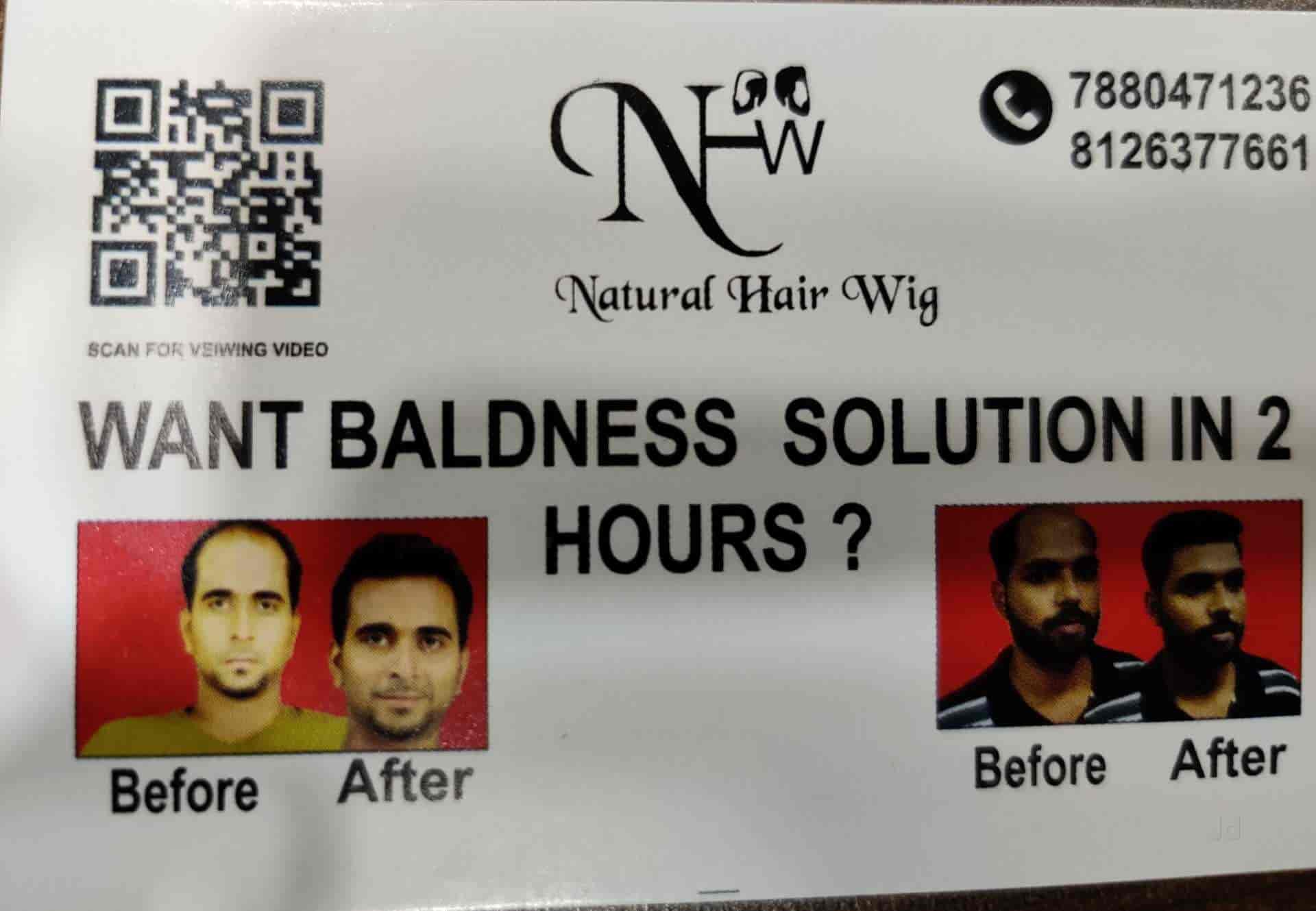 CLOSURE WIGS (5x5) | CLOLITICAL HAIR