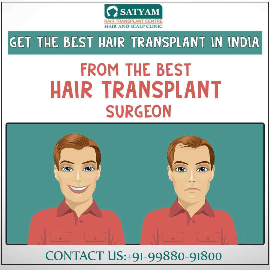 Hair Transplant In Men,Its Benefits And How we Perform | Hair transplant, Hair  transplant cost, Hair restoration surgery