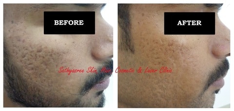 Sathyasree Skin Hair Cosmetic & Laser Clinic in Seshadripuram,Bangalore - Best Cosmetic Laser Surgeons in Bangalore - Justdial Sathyasree Skin Hair Cosmetic & Laser Clinic in Seshadripuram,Bangalore - Best Cosmetic Laser Surgeons in Bangalore - Justdial