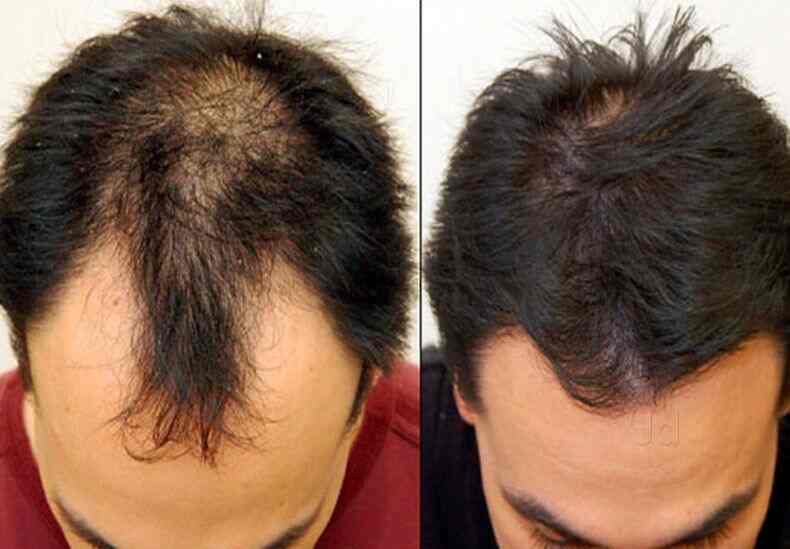 Beau Mondes Hair Fixing in Koramangala,Bangalore - Best Hair Care Product Dealers in Bangalore - Justdial Beau Mondes Hair Fixing in Koramangala,Bangalore - Best Hair Care Product Dealers in Bangalore - Justdial