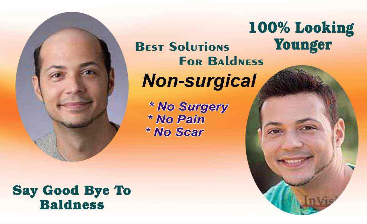 Wigsfinity, Rajajinagar 1st Block Wig Dealers in Bangalore Justdial