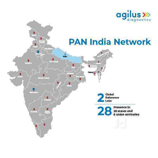 Agilus Diagnostics Ltd in Mahadevapura,Bangalore Best Blood Test Home Visit in Bangalore