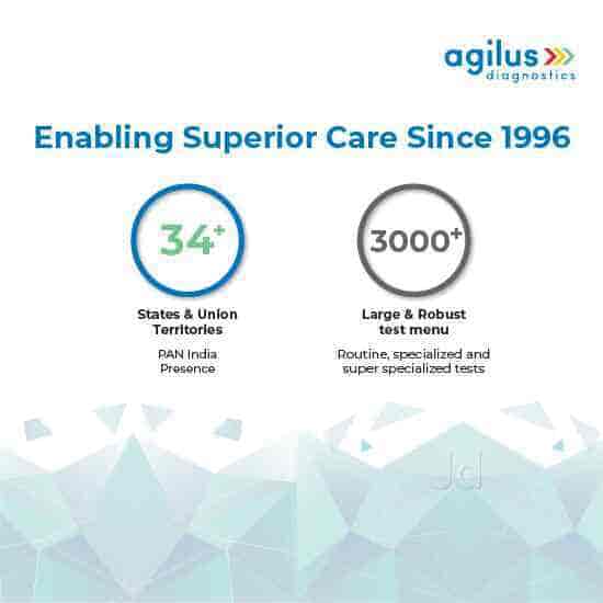 Agilus Diagnostics Ltd in Mahadevapura,Bangalore Best Blood Test Home Visit in Bangalore