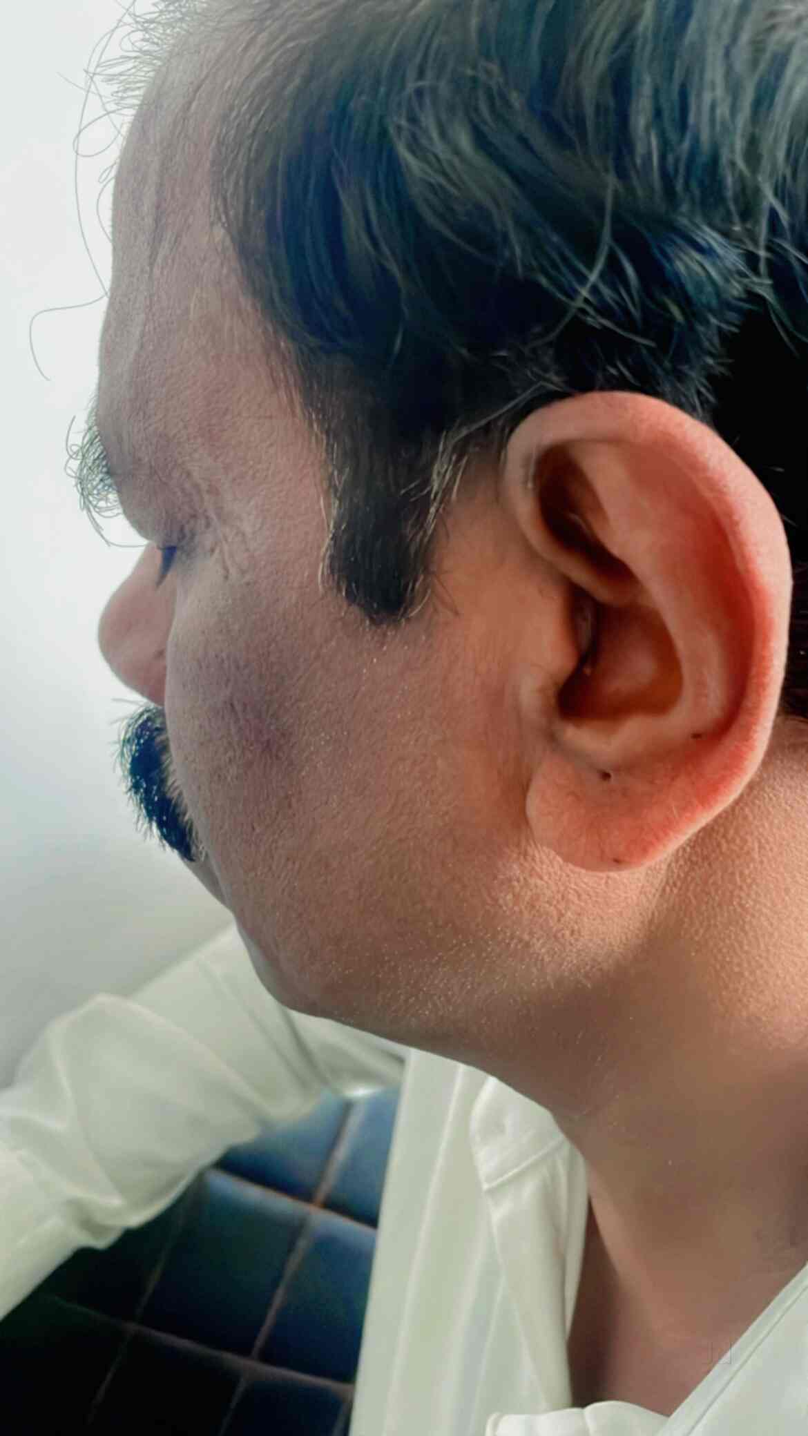 Nagu Speech and Hearing Clinic in Chandra Layout,Bangalore Best