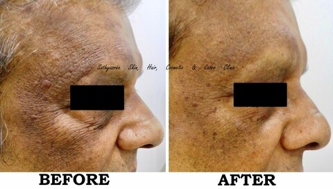 Dr Chandan K S (Sathyasree Skin Hair Cosmetic & Laser Clinic) in Seshadripuram,Bangalore - Best Aesthetic Dermatology Doctors in Bangalore - Justdial Dr Chandan K S (Sathyasree Skin Hair Cosmetic & Laser Clinic) in Seshadripuram,Bangalore - Best Aesthetic Dermatology Doctors in Bangalore - Justdial