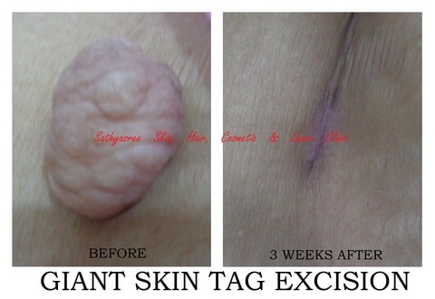 Dr Chandan K S (Sathyasree Skin Hair Cosmetic & Laser Clinic) in Seshadripuram,Bangalore - Best Aesthetic Dermatology Doctors in Bangalore - Justdial Dr Chandan K S (Sathyasree Skin Hair Cosmetic & Laser Clinic) in Seshadripuram,Bangalore - Best Aesthetic Dermatology Doctors in Bangalore - Justdial