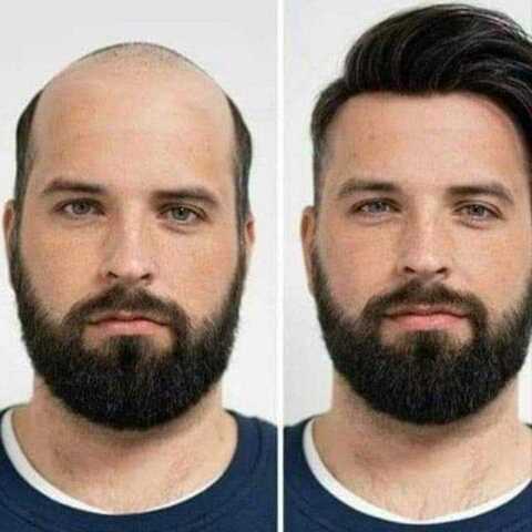 Star Hair Weaving and Bonding Centre in Jp Nagar 1st Phase,Bangalore - Best Men Wig Dealers in Bangalore - Justdial Star Hair Weaving and Bonding Centre in Jp Nagar 1st Phase,Bangalore - Best Men Wig Dealers in Bangalore - Justdial