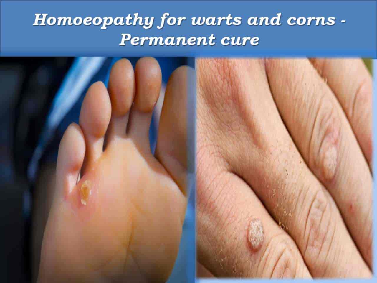 St Joseph Homeopathic Clinic in Hutchins Road,Bangalore Best Homeopathic Clinics in Bangalore