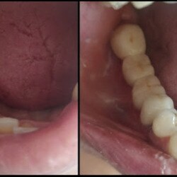 all care dental center