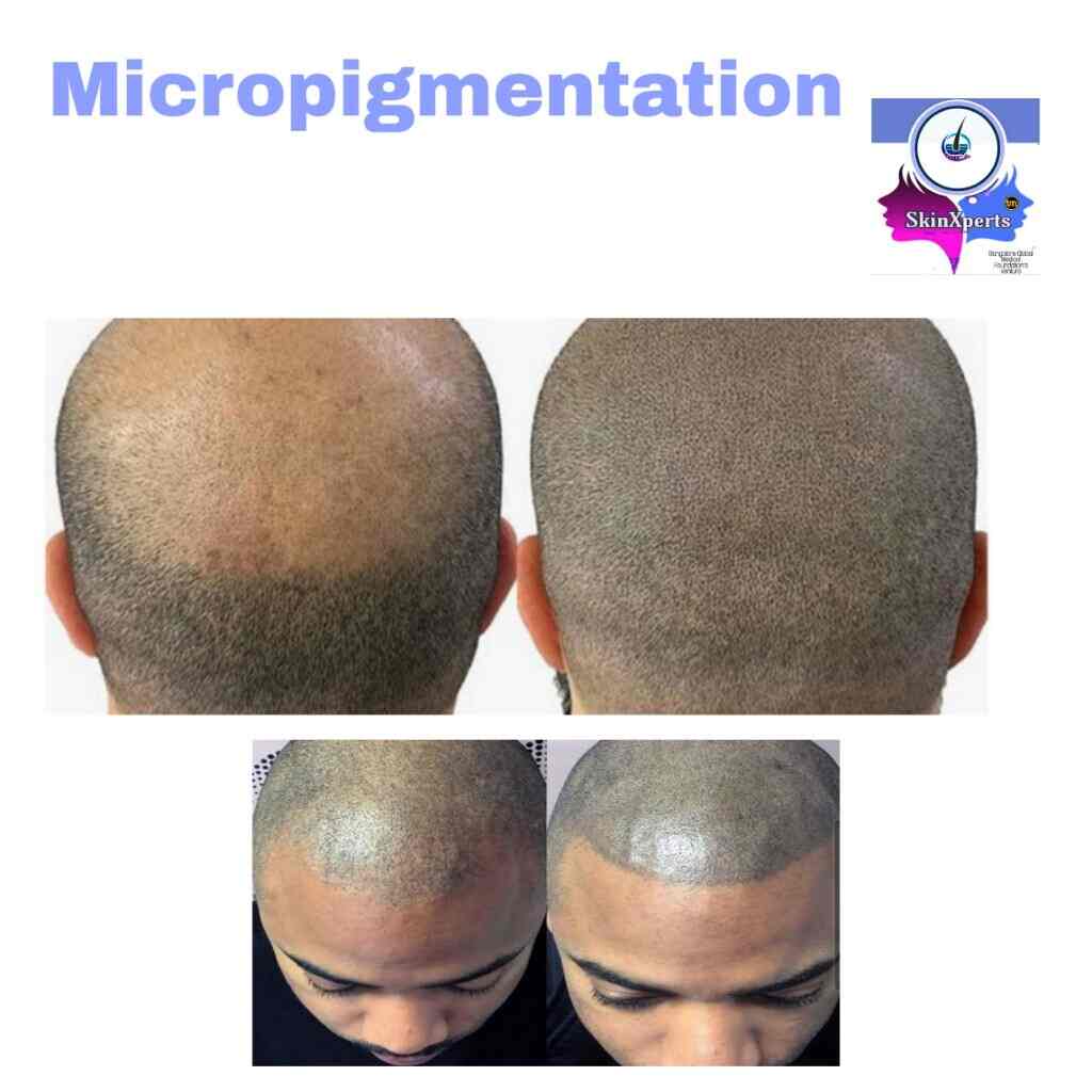 Dr. Prabhakar M Sangolli (Skin Care Center) in Rajajinagar,Bangalore