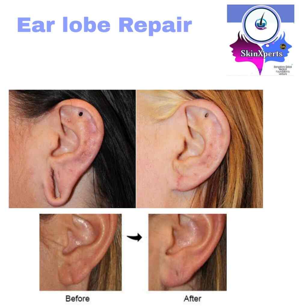 Dr. Prabhakar M Sangolli (Skin Care Center) in Rajajinagar,Bangalore