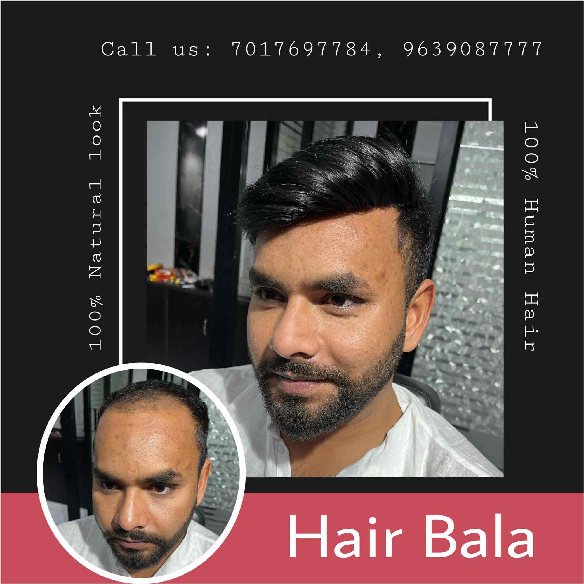 Anas Sheikh Hair Solutions - Hair Replacement Service in Laxmi Nagar