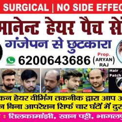 Bhagalpur Permanent Hair Patch Center in Tilkamanjhi - Best Men Beauty Parlours For Hair Weaving in Bhagalpur - Justdial Bhagalpur Permanent Hair Patch Center in Tilkamanjhi - Best Men Beauty Parlours For Hair Weaving in Bhagalpur - Justdial