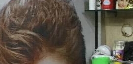 Top Hair Weaving Services In Bharatpur Fix Your Baldness Justdial