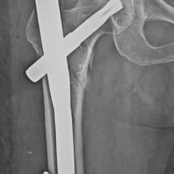 Top Orthopaedic Doctors in Zadeshwar Road Bharuch - 𝗕𝗼𝗼𝗸 ...