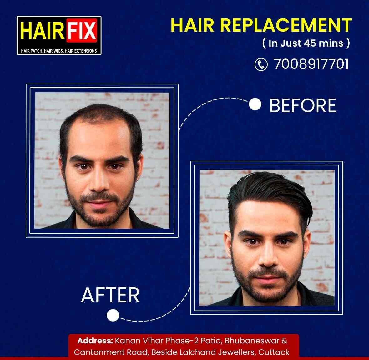 Top Hair Weaving Services in Patia Gds, Bhubaneshwar - Fix your baldness -  Justdial