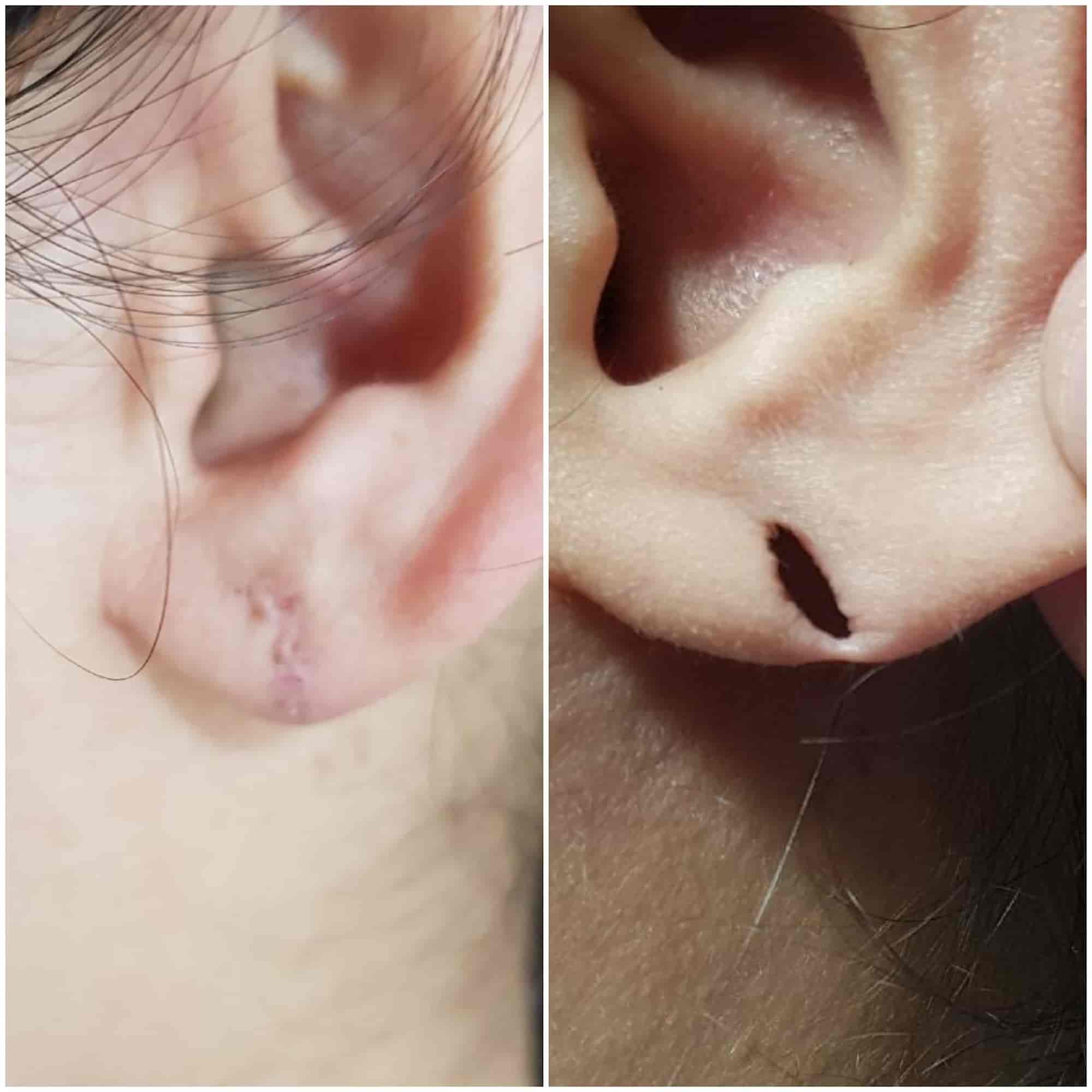 Dr Vikas SharmaLaser Care Clinic Skin Hair Cosmetic & Laser in Ring Road,Bilaspurchhattisgarh