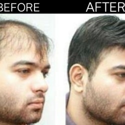 Kolkata Hair Weaving Centre Chas Bokaro Beauty Parlours For