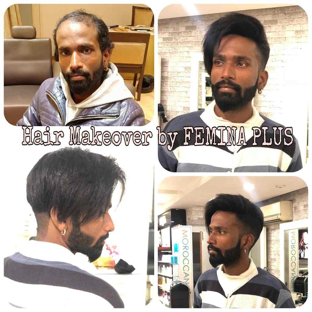 Top Hair Weaving Services In Chandigarh Fix Your Baldness Justdial