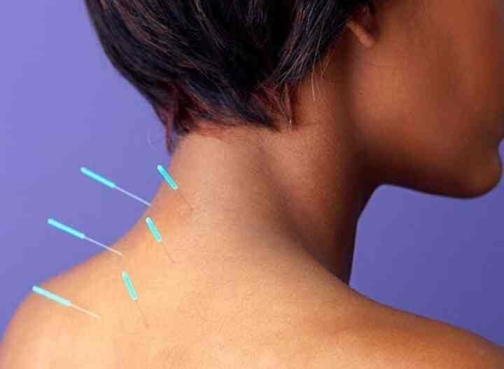 Top Acupuncture Doctors in Nungambakkam Best Acupuncturists Justdial