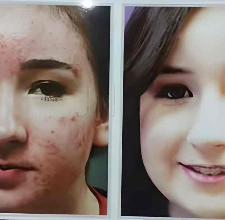 best skin doctor in royapuram