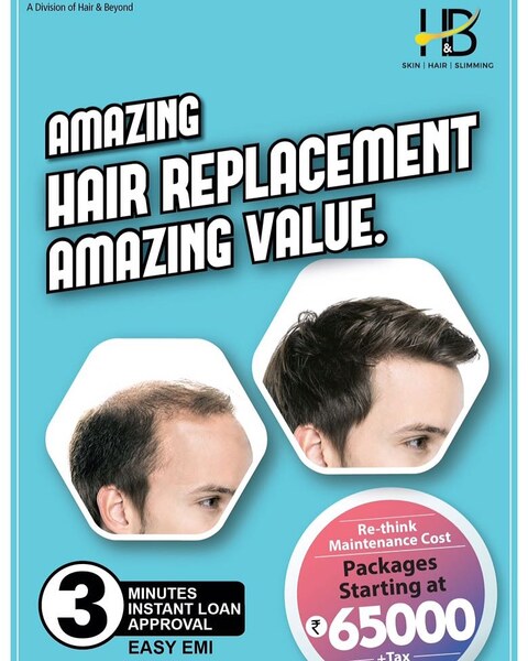 Hair & Beyond in Nungambakkam - Best Hair Loss Doctors in Chennai - Justdial Hair & Beyond in Nungambakkam - Best Hair Loss Doctors in Chennai - Justdial