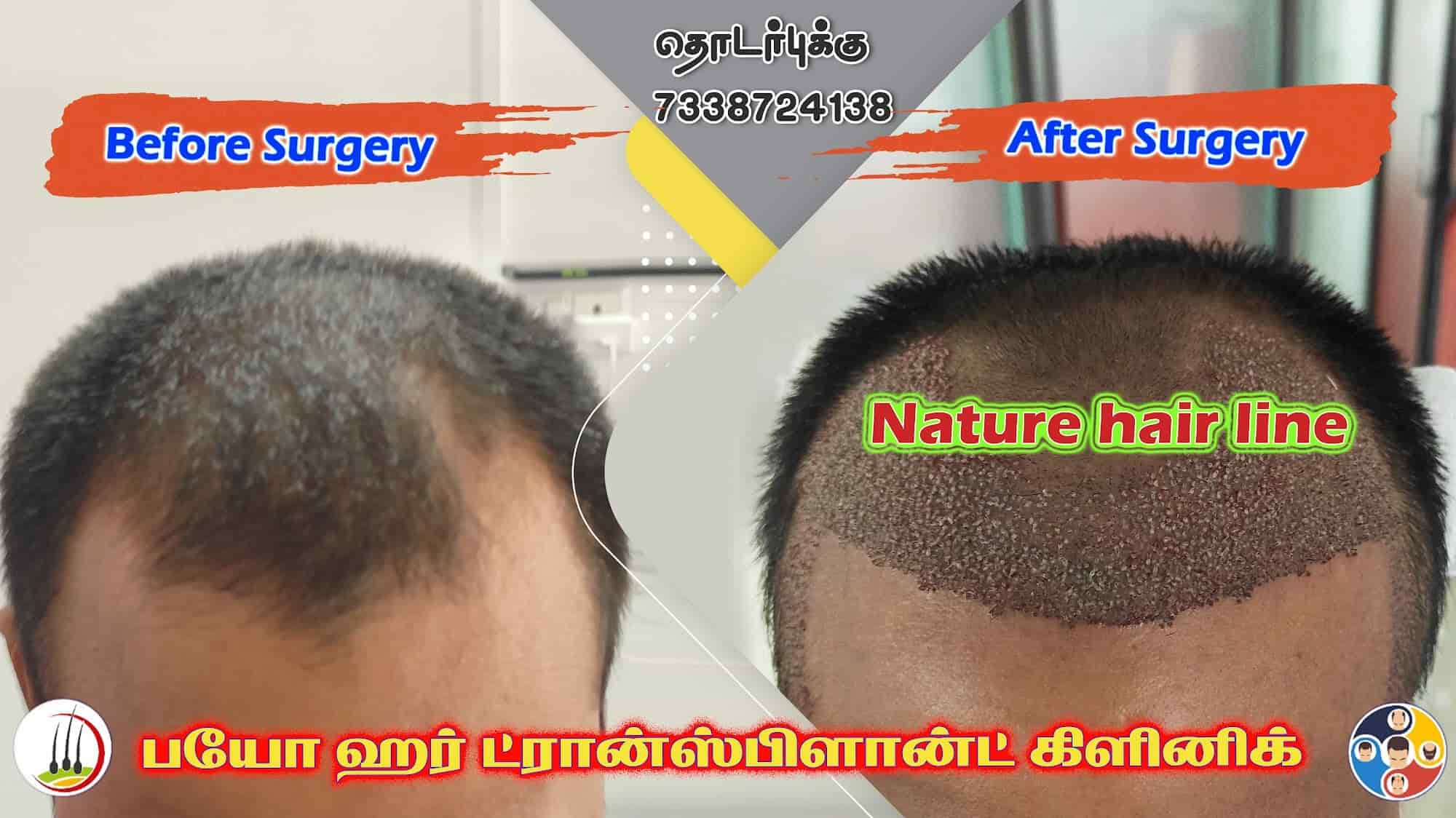 Top 140+ best hair doctor in chennai latest camera.edu.vn