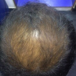 Hairtistic Hair Studio in Vadapalani,Chennai - Best Hair Treatment Clinics in Chennai - Justdial Hairtistic Hair Studio in Vadapalani,Chennai - Best Hair Treatment Clinics in Chennai - Justdial