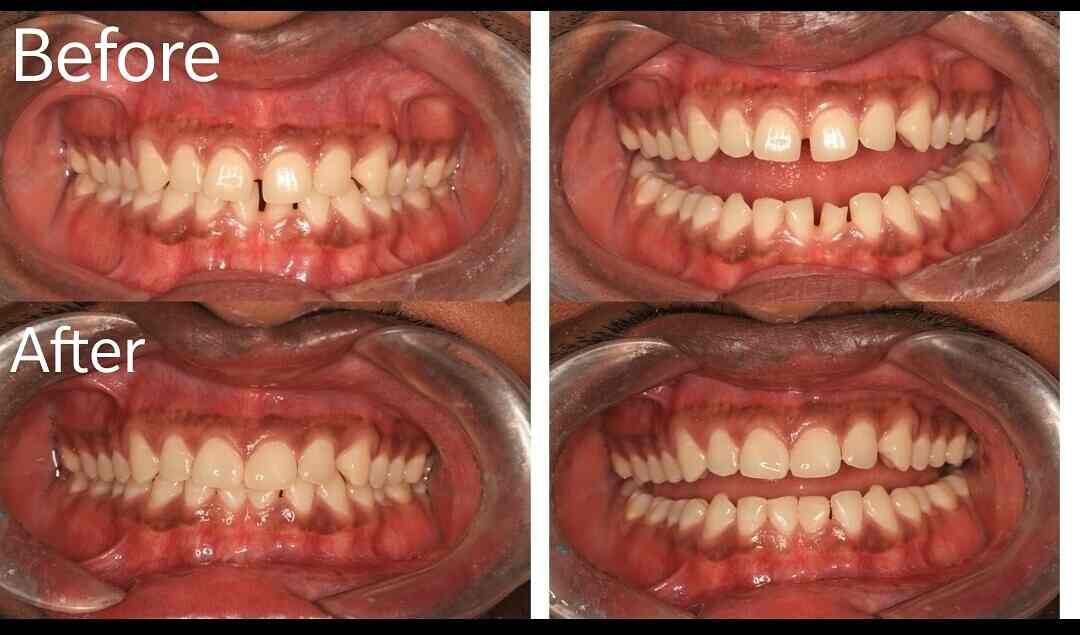 BEST Laser Dental Clinic in Valasaravakkam,Chennai Best Dental Clinics in Chennai Justdial