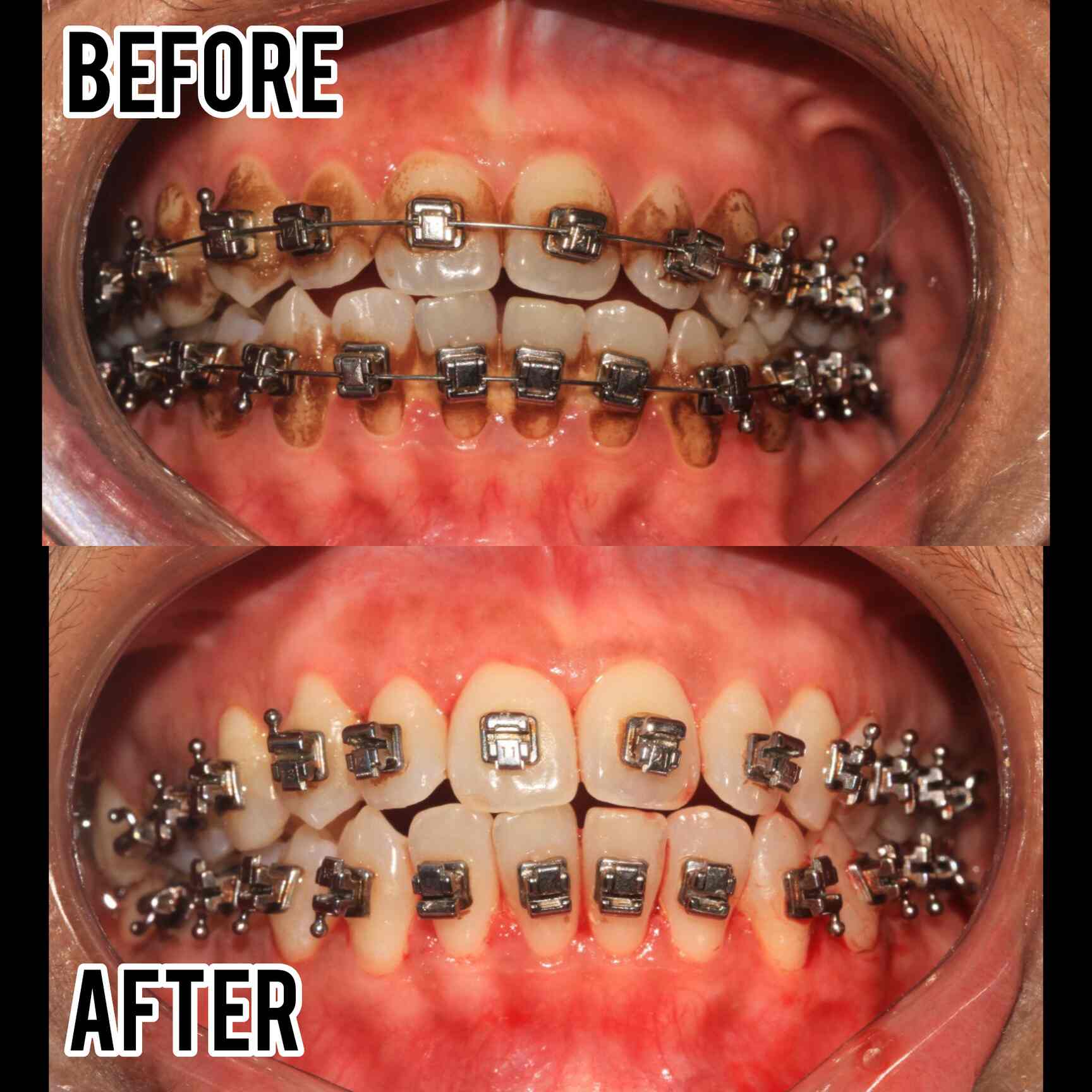 BEST Laser Dental Clinic in Valasaravakkam,Chennai Best Dental Clinics in Chennai Justdial