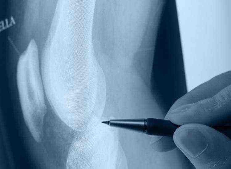 Petha Gownder Bone Setting Hospital Hospitals Book Appointment Online Hospitals In Town Hall Coimbatore Justdial