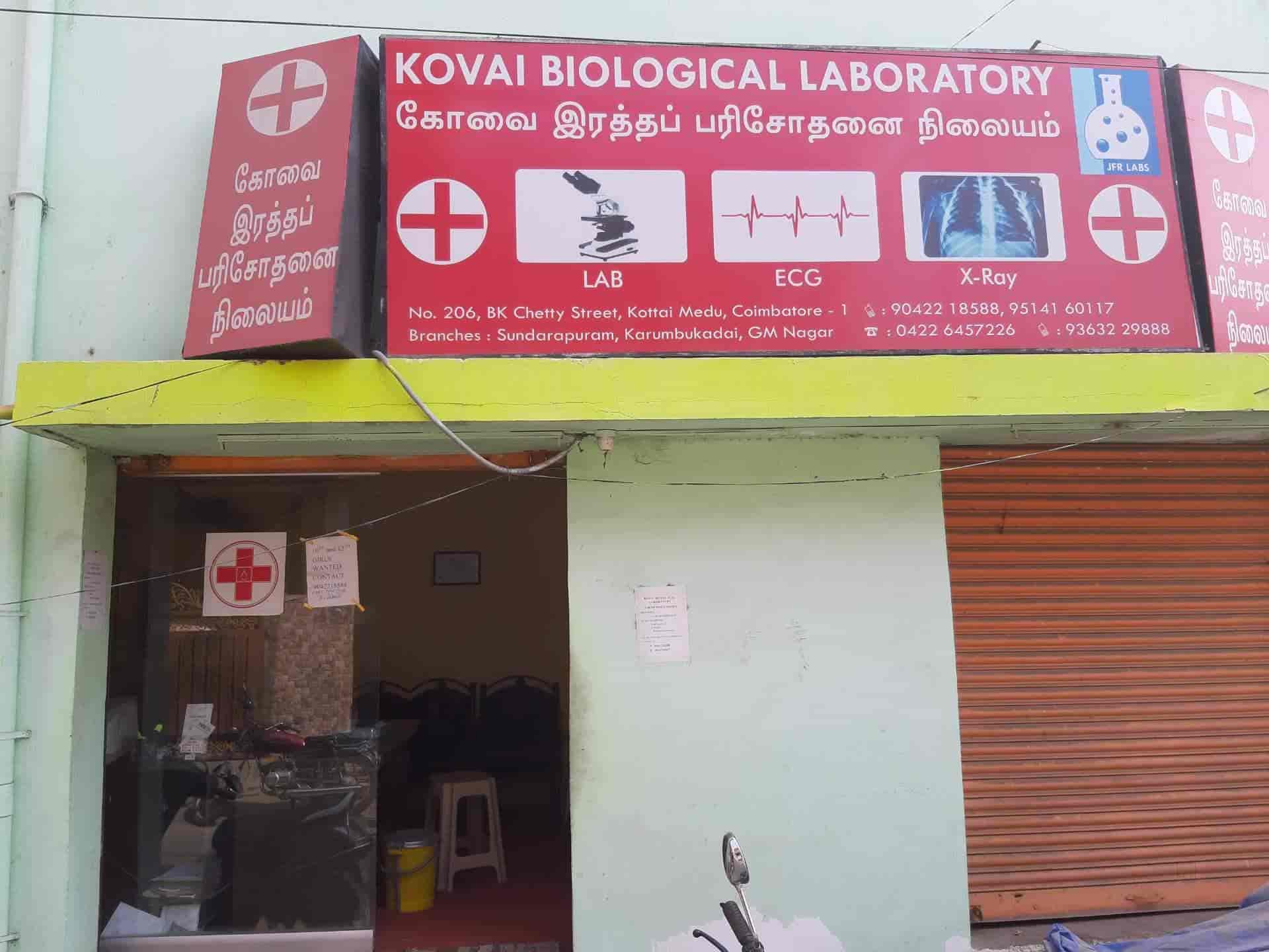 Kovai Biological Laboratory in Town Hall,Coimbatore Best Blood
