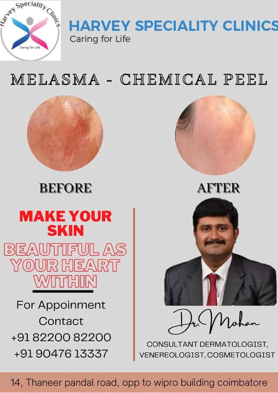 Harvey Skin in Peelamedu,Coimbatore Best Skin Care Clinics in